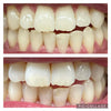 e'Stella Aesthetics - Teeth Whitening